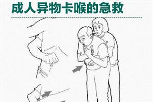 急救法